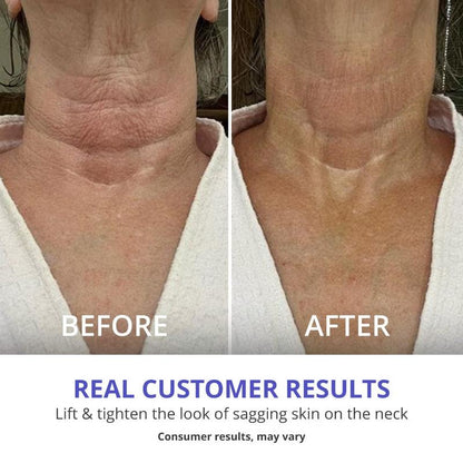 Vetalixe - Tighten & Lift Neck Cream